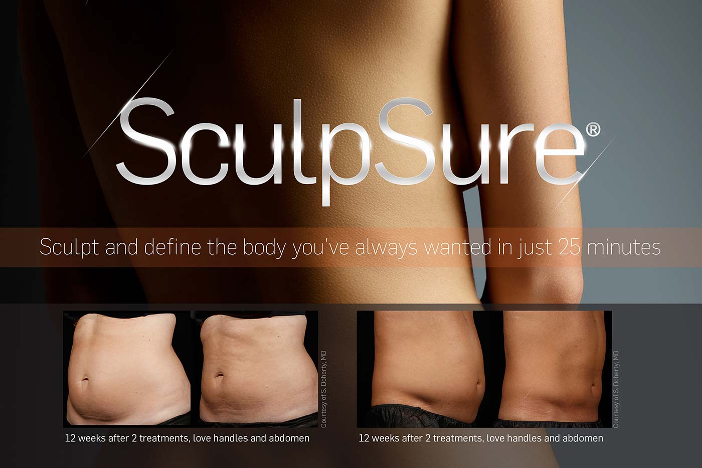 Sculpsure-5